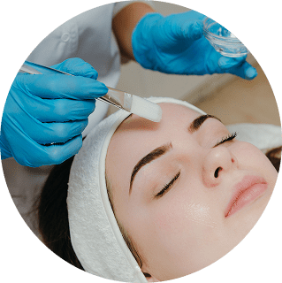 Peel Treatment